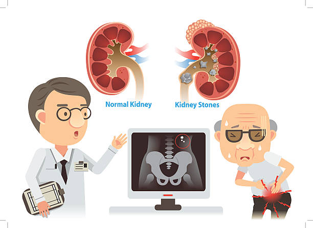 Acute Kidney Injury