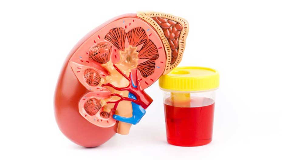 Blood Urine